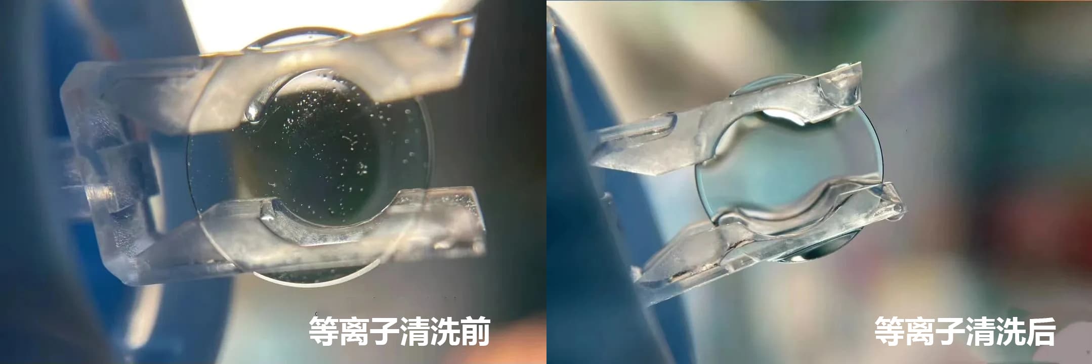 角膜塑形鏡（OK鏡）草莓视频APPIOS下载清洗技術的應用